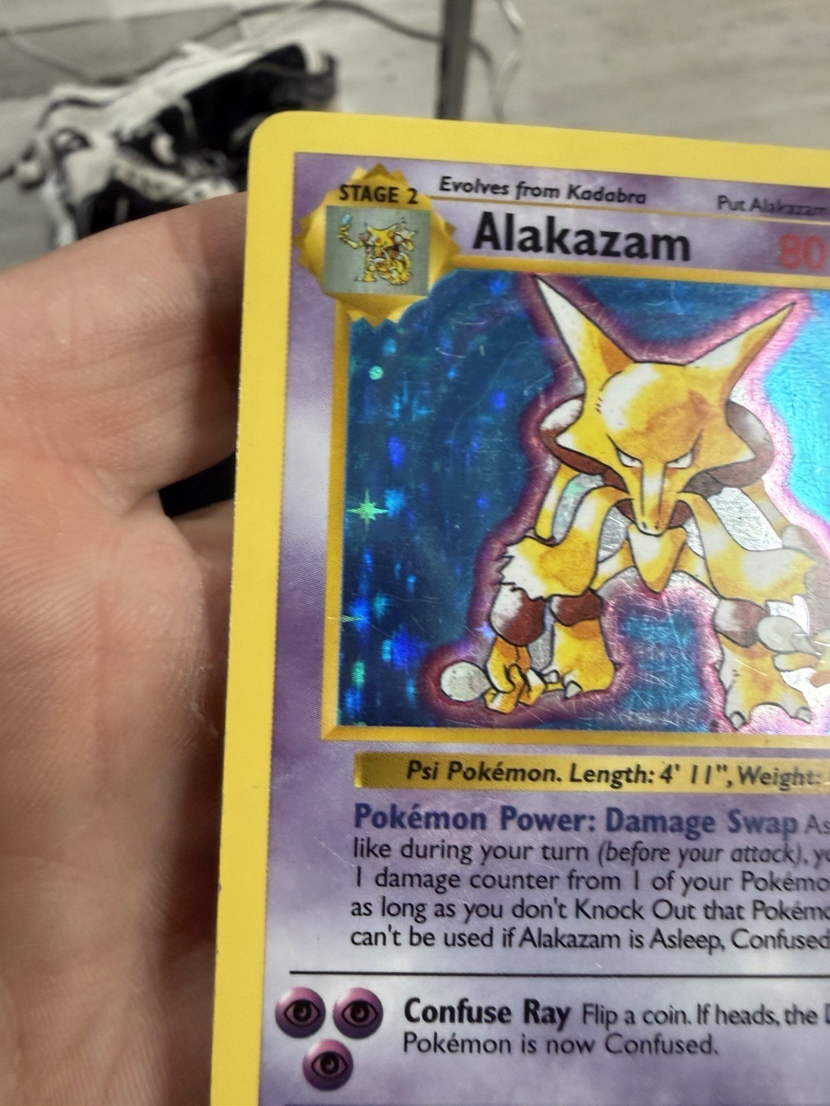 Alakazam 001/102 Base Set (Shadowless) Holo