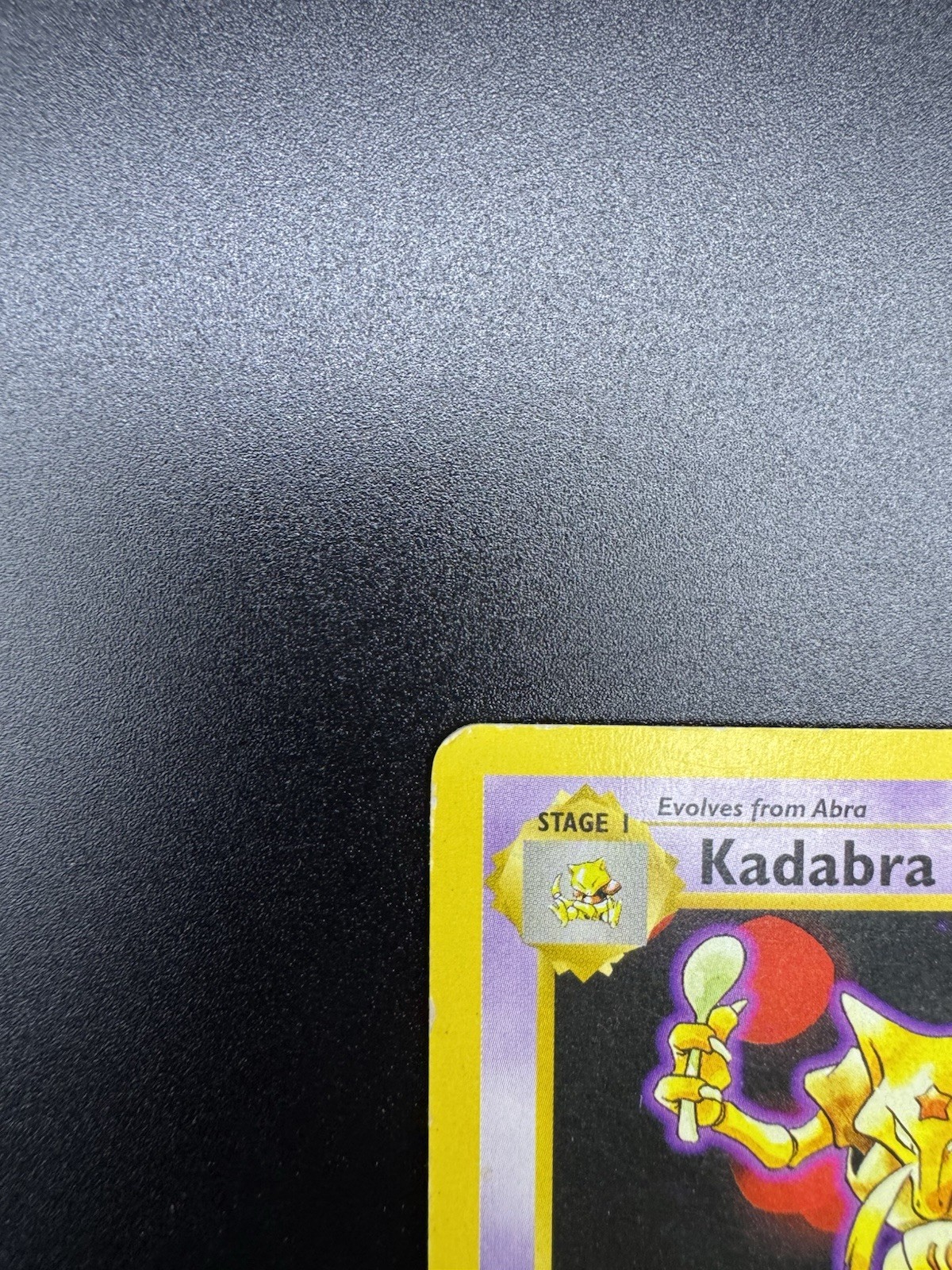 Kadabra 032/102 Base Set 1st Edition